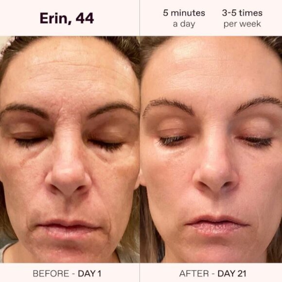 4-in-1 Radiant Renewal Red and Blue Light Skincare Wand Therapy (Rose Gold) New - Picture 10 of 14